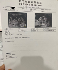 ��17���򴩺�����죬����Ĳ����£�