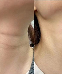 �����ҵľ��ƣ���Ŀ�û����