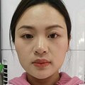 瘦脸后看着还更年轻了
