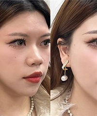 ��ͨ����Ұ��ü֮�󣬻��������ĸı�