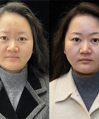 ��ֻ��100�࣬����Ƥ�������˼�����