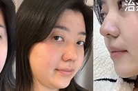20分钟就能拥有紧致V脸,像瘦了10斤一样