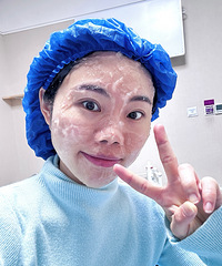 暗黄皮肤做了一次黑金超光子,肤色瞬间就变亮了