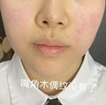 法令纹都快真没了