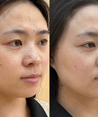 ���˹����۷�����ɫһ�¾�����3����