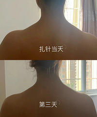 ����ݼ�ķ���������Ϊ�ر���Ч��������11���ı仯