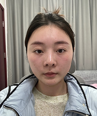 瘦脸还是得靠这个方法,轻松就能拥有紧致下颌线