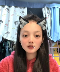 做了全飞秒近视手术,400多度的近视,现在恢复到高清5.0