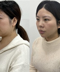 ��������������������������10���