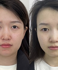 ��һ�γ�Ƥ�룬���֪�������ʵ������