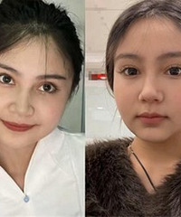 ����4���µı仯���㿴Ч������