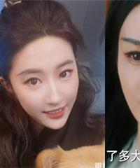难怪怀疑姚晨、刘亦菲做了缩唇手术