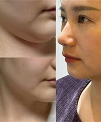 �����ҵġ�˫�°���ʧ����