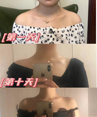 �ݼ�25�������仯̫�����ˣ�������봩����¶���ҵ�ֱ�Ǽ�