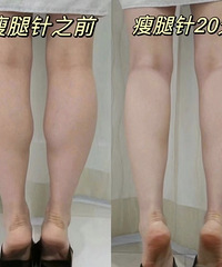 ֻ��20��ı仯���ҵ�С�Ⱦ����ϸ�ˣ�����Ҳ�ܴ�����ȹ��