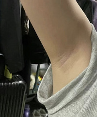 夏天到了,大家是怎么做腋下管理的?说说处理腋毛的好方法