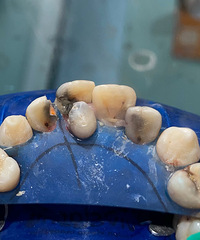 [����]���ú��Ӻ�̼�������ˣ���Щʮ������������Ҳ����ź���