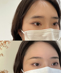 ���ò����ϣ�����Ұ��ü���ҿ����������˺ö࣡û�ԱȾ�û�˺�