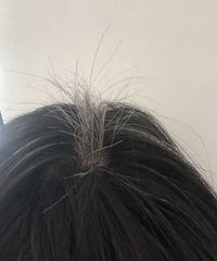才30多就长白头发,有人跟我一样吗?怎么处理