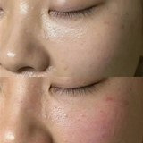 敏感肌就这样修复吧