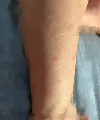 ���룡��ũ���������ȫ�Ǻ������������ҧ����