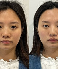 让素颜发光的招牌超光子,肤色提亮3倍
