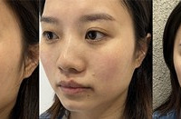 能淡化红血丝,细腻毛孔的招牌超光子!肤色提亮3倍