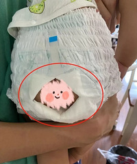 [����]���������ӹ�����������ֽ����Ͽ����촰��͸��