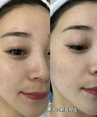 ڽ𳬹ЧúŶҪ׵Ķȥһ