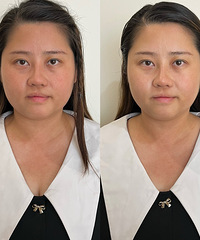 不做医美也能抗衰!这个皮肤管理能抗老,美白,修复,才199元