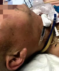 ���ǵϡ�©�硱�¼�Խ��Խ��ҽԺ���֤���ع�