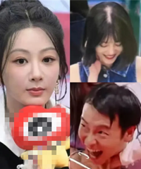 有点秃然,明星也用假发片、发际线粉