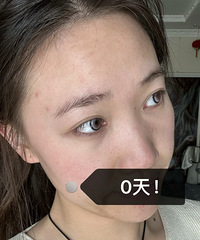 真的能够一键消除泪沟和黑眼圈吗?用这个方法,真的太有效了