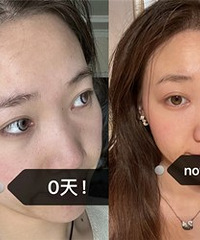 û���ṵ֮����Ĳ�ô�