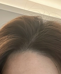 低成本避免秃头的日常方法!这篇一定能帮到你