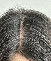 有什么方法能控制长白发?亲戚60,每天这样做,一根白发都没有