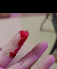 ��ѧ�ң��ļ�ͶʳС��è����ָ��ҧ��Ѫ����ֹ