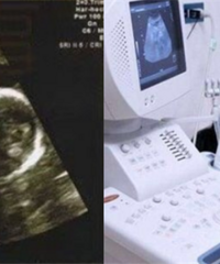 B�����ֽ��ͱ�ƾͺ��ˣ�ѧB��֪ʶ��ʲô�ã�