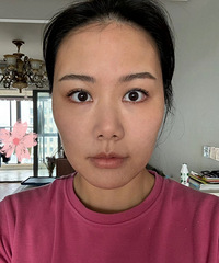 做了医美项目,才懂了大家说的面部平整度是怎样