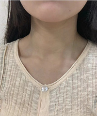 只打了一次颈纹针,效果惊艳!一支嗨体1.5和一支嗨体2.5