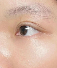 这个方法祛眼纹是真的很有效,看看我做了3次后的差别