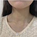 我的颈纹真的快没了