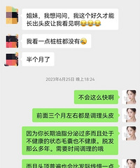 摆摆我的生发之路,从稀疏到茂密是真可以办到的