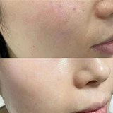 这样做,皮肤越来越好