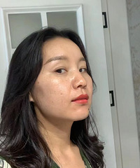 坚持每个月都做一次水光,前后的皮肤状态,真的差别好大啊