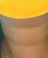 我的颈纹达到了4级深度,只有靠这个方法做改善!现在就穿低领装