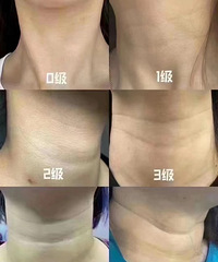 我的颈纹达到了4级深度,只有靠这个方法做改善!现在就穿低领装