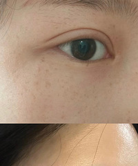 Ҫ߻ǵÿҽһγƤ+ˮ⣬Чͳ