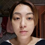 原来眼袋真的可以消失