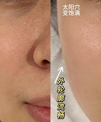 199元做的无痛皮肤管理真的好棒!提升紧致美白,效果直逼医美